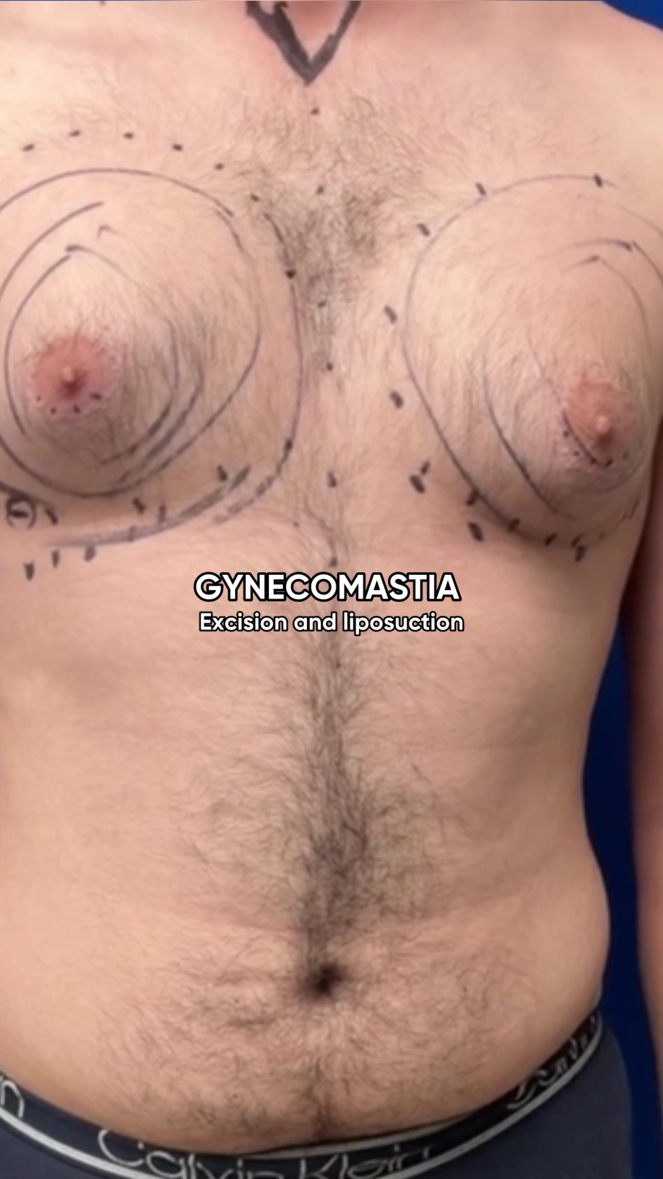 @Cohen MD Plastic Surgery