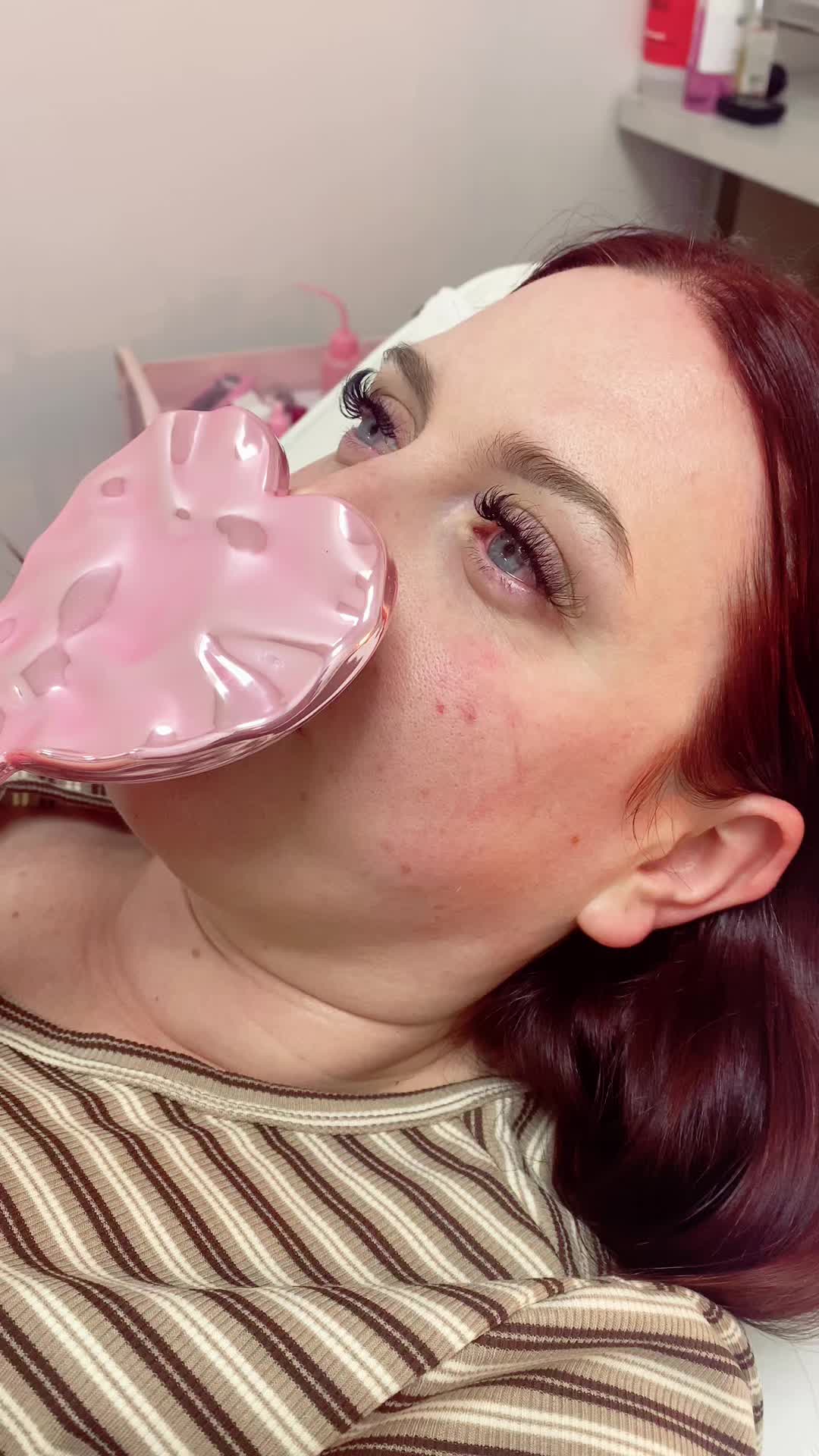 @Simz Aesthetics