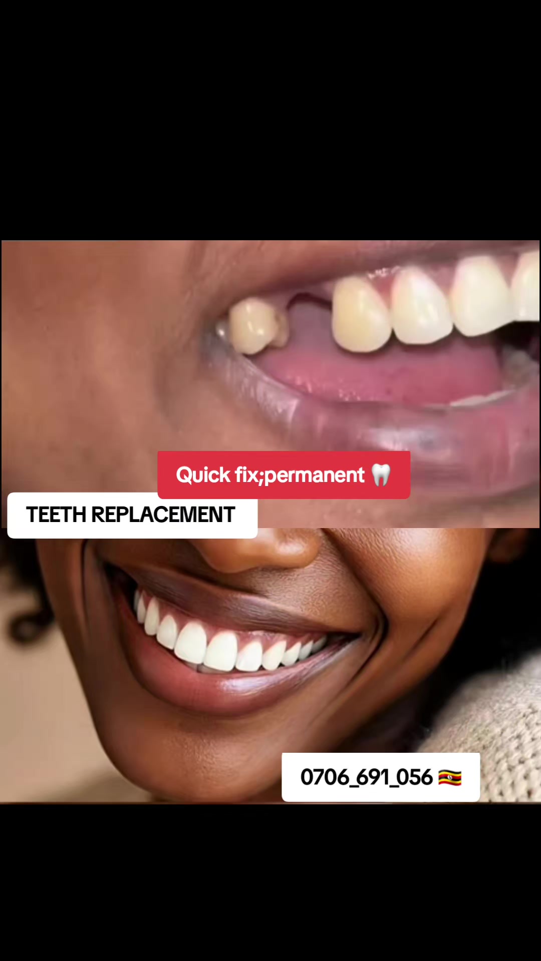 @Dental studio.🦷.Kampala