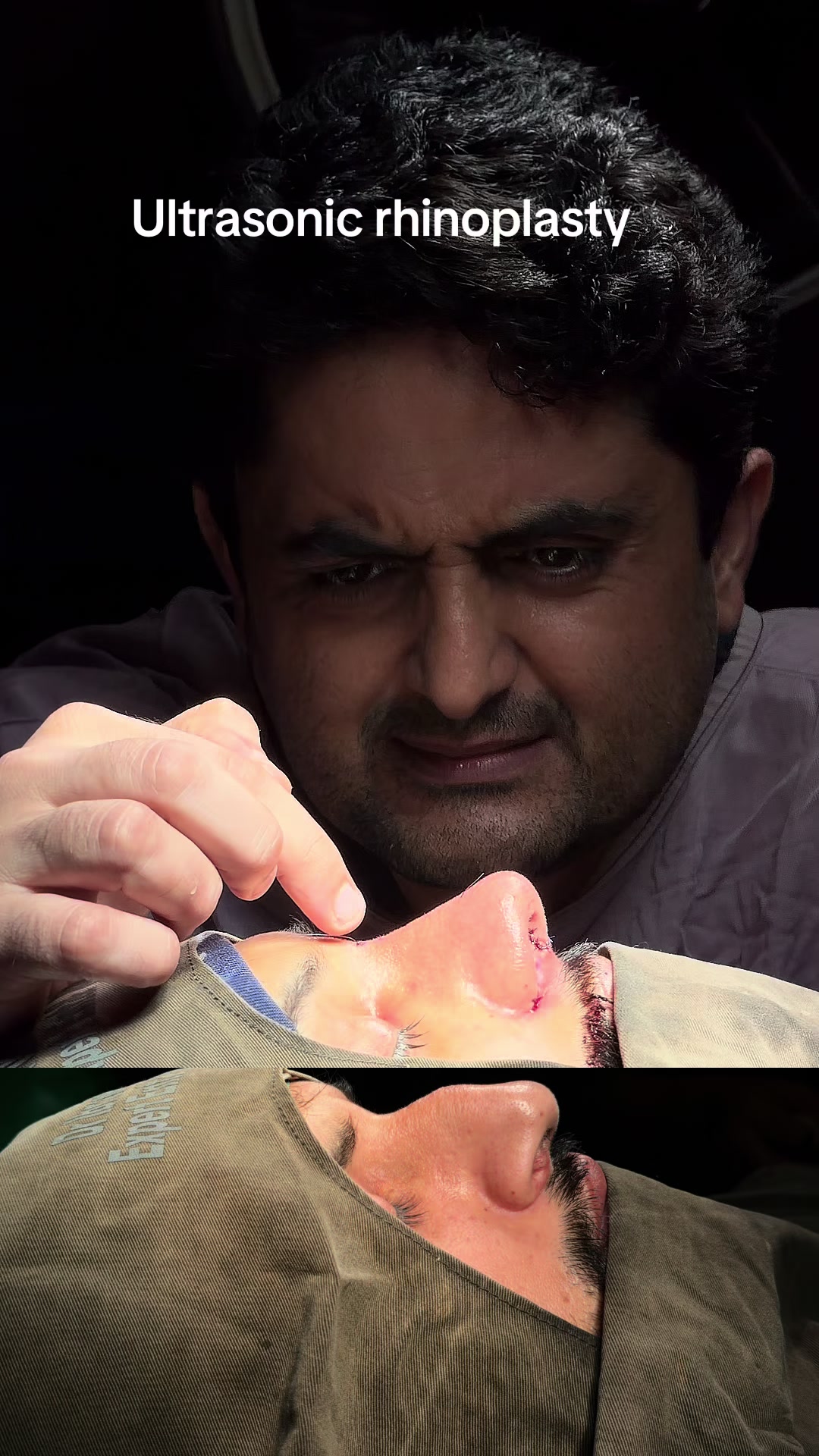 @Dr Ibrar ENT & Rhinoplasty