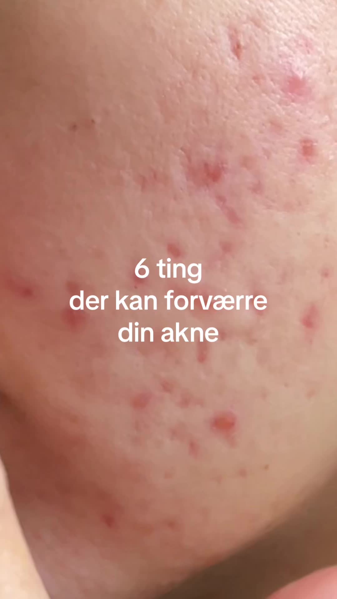 @Rønsbøl — Self Care