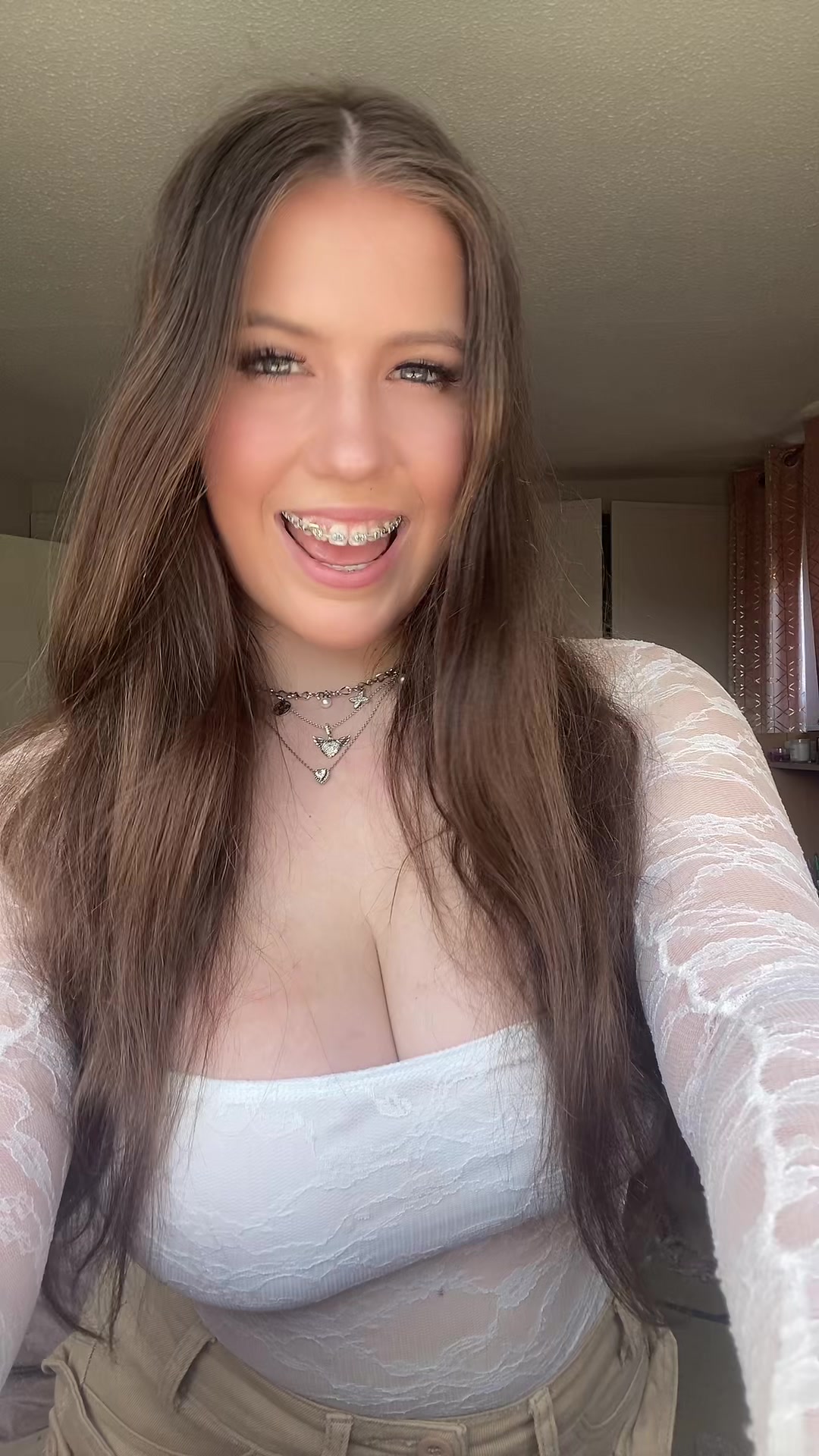 @Anya