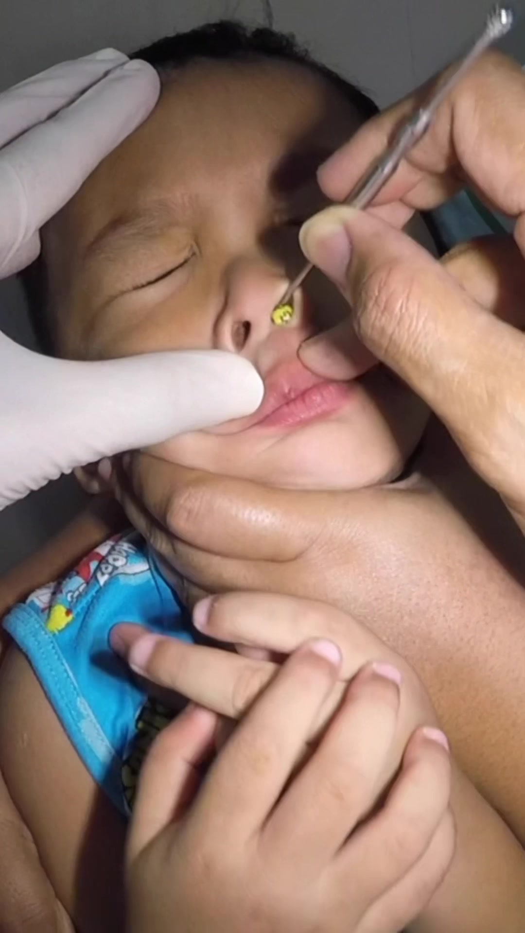 @TheEarwaxSpecialist