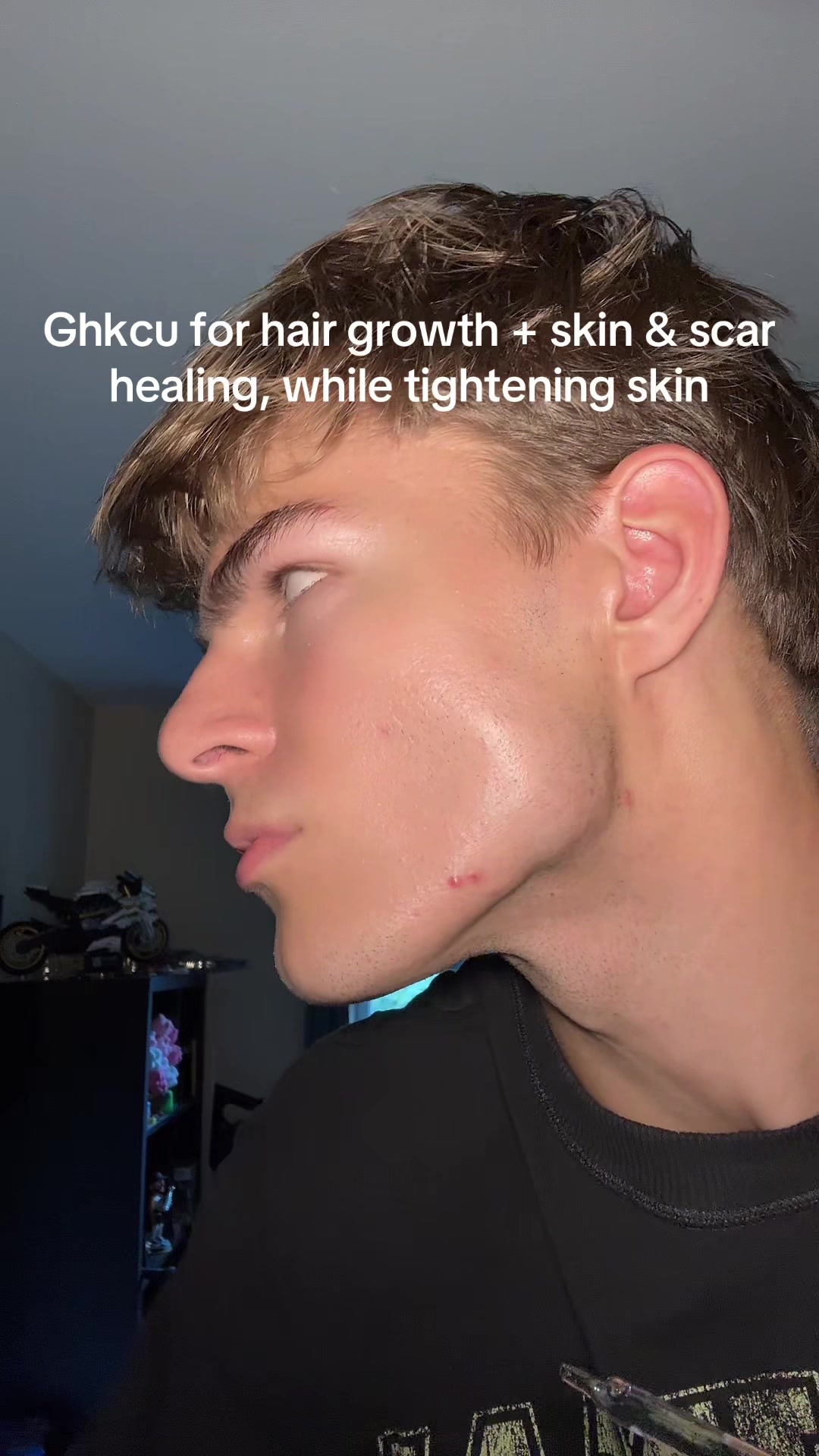 @Finn