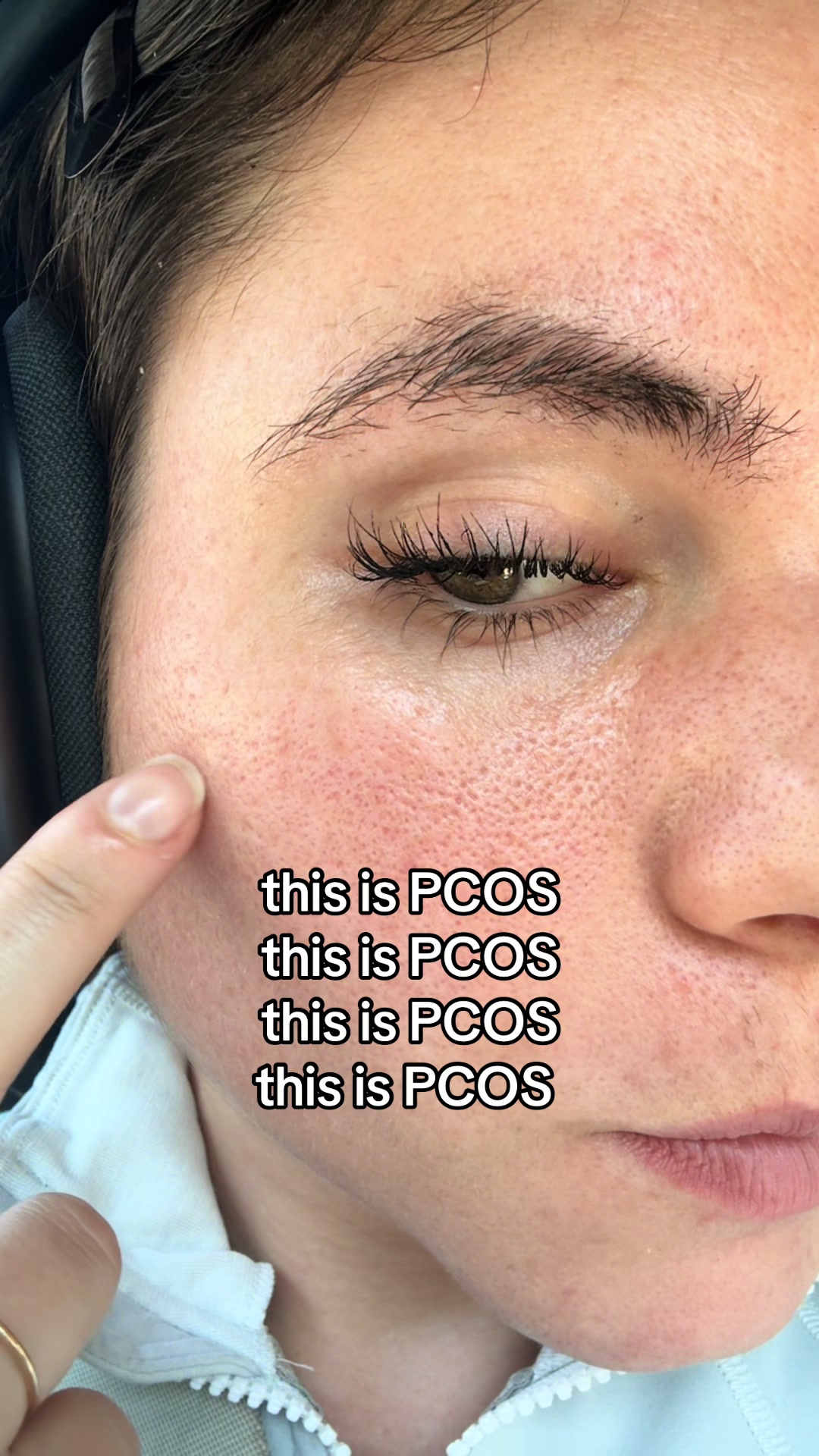 @Sarah | PMOS/PCOS life + tips