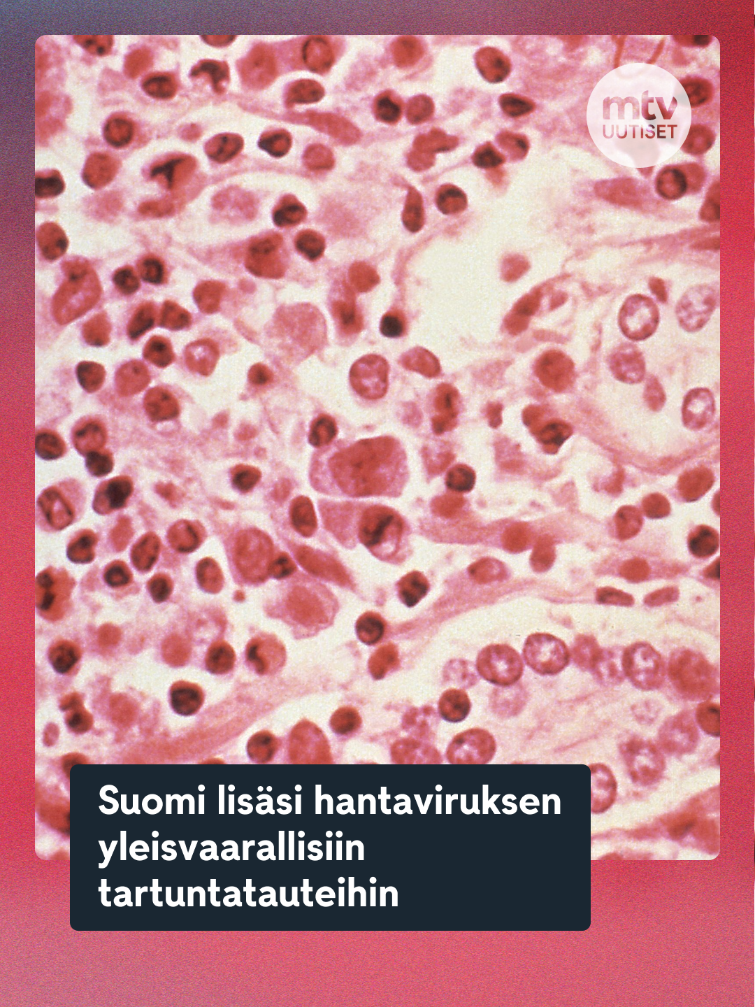 @MTV Uutiset