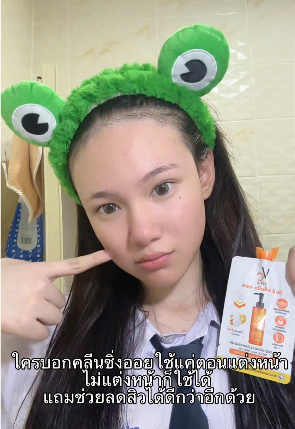 @แอลลี่