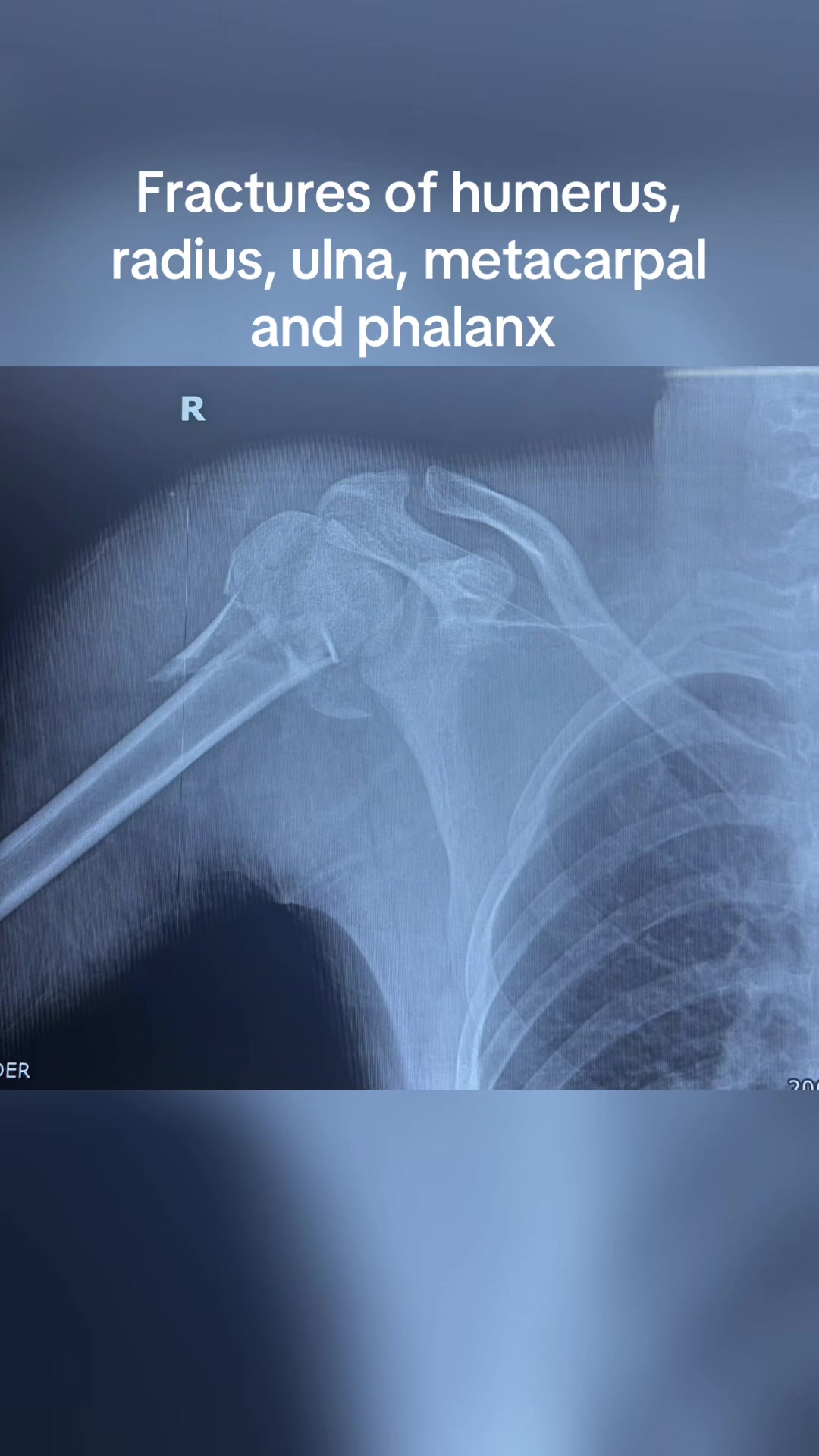 @Orthopedic_Surgeon_Arbind