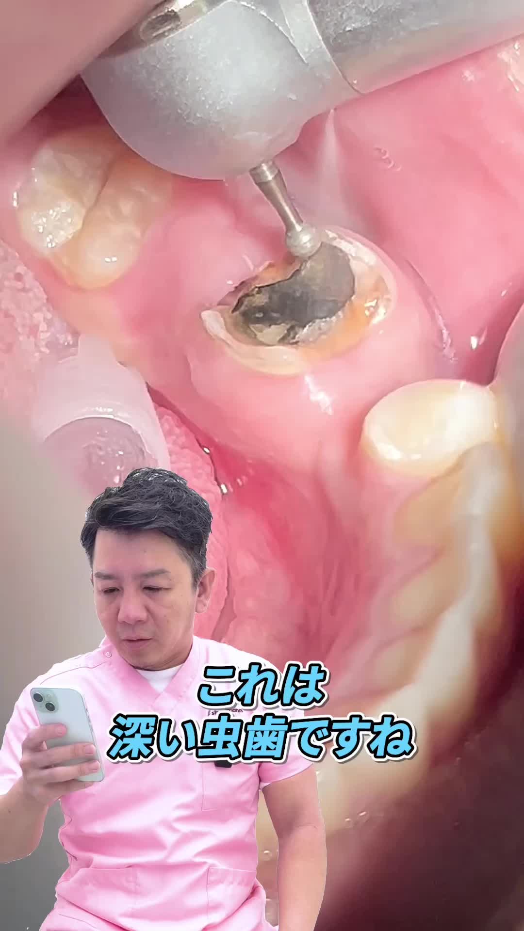 @セラミックの隼人先生