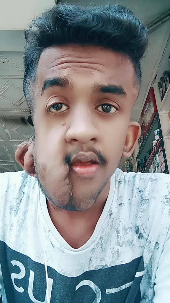 @Anidhya Vaish