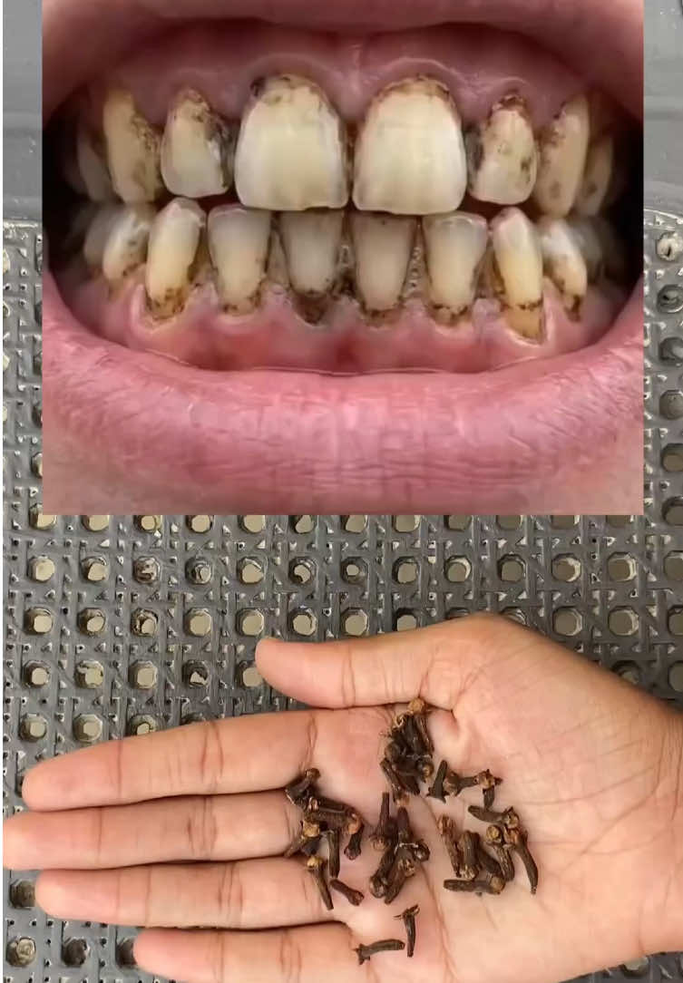@RemdyGuru35