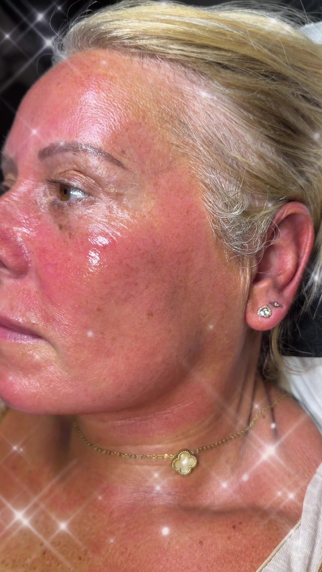 @Skinglowbysophie