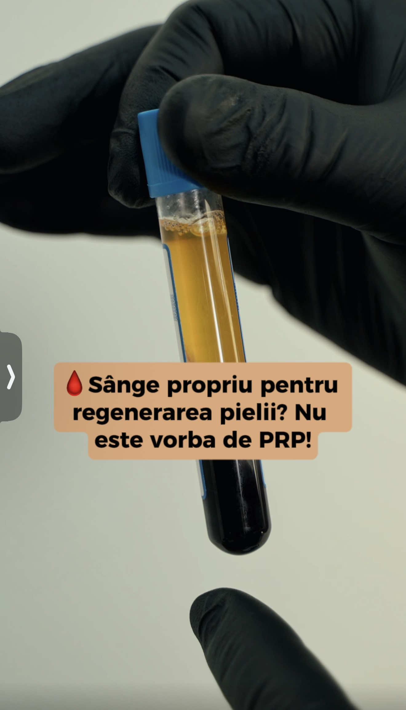 @Dr. Lucian Popa | MD PhD