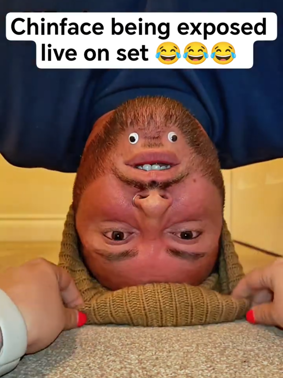 @Chinfaced