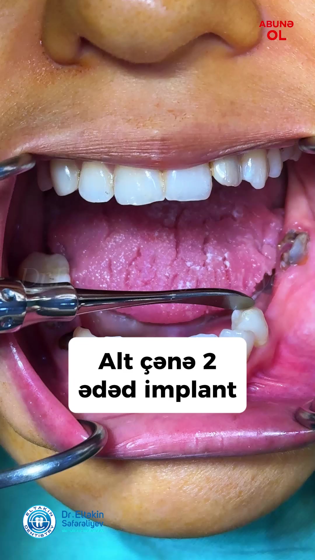 @eltakindentistry