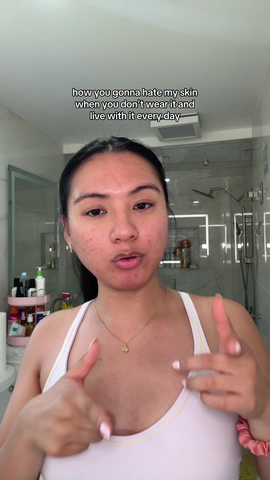 @jennilee • thatacnegirlie