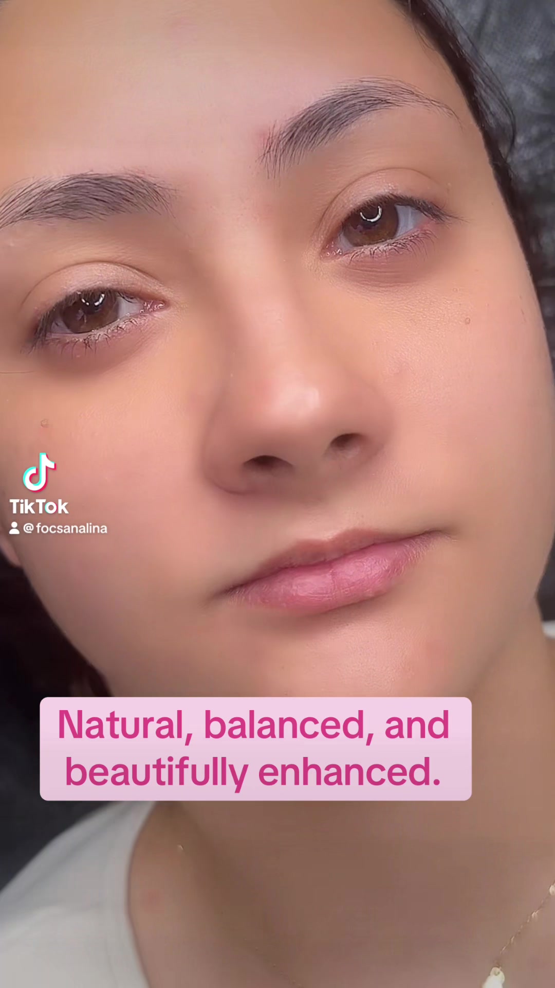 @Alina Focsan