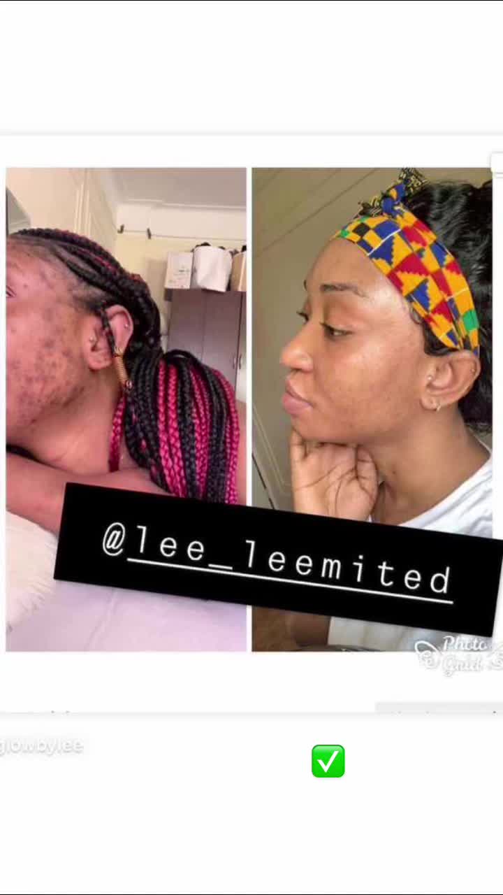 @GLOWBYLEE-skincare