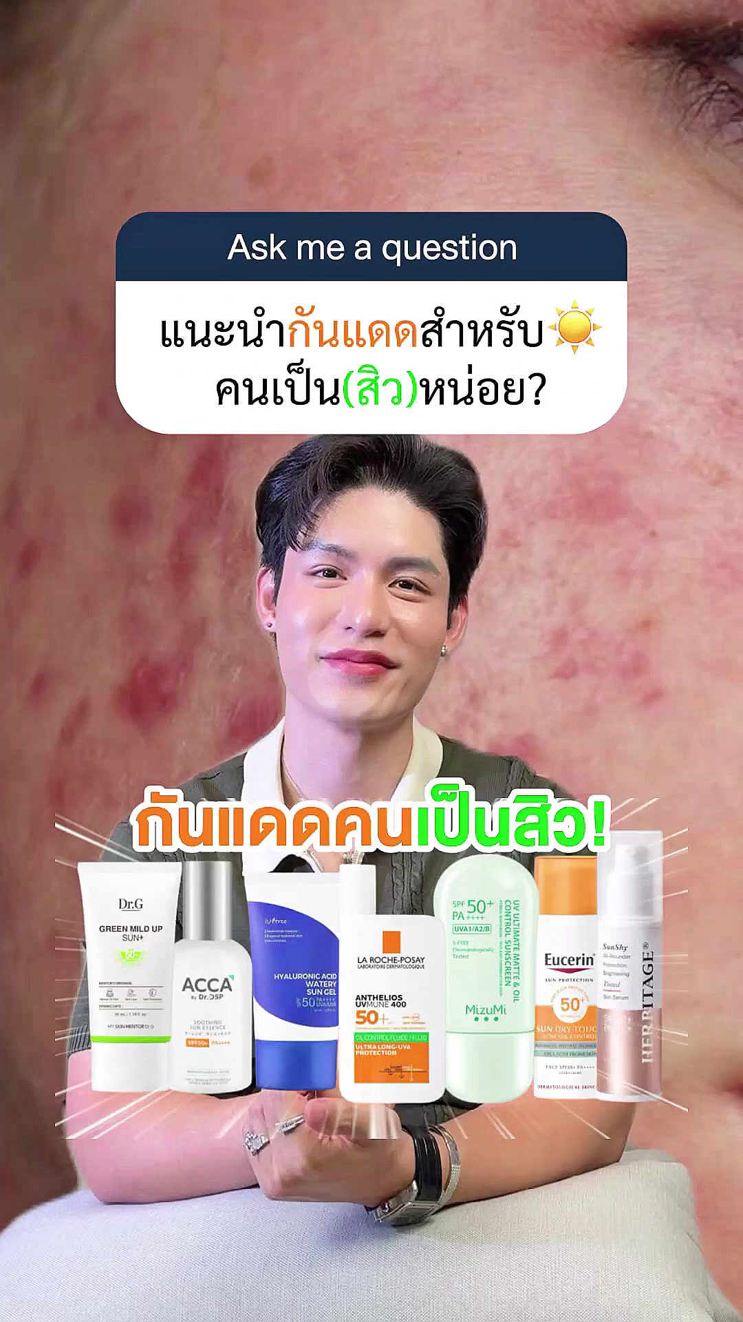 @หนูปอนด์ที่ชอบเลเซ่อร์
