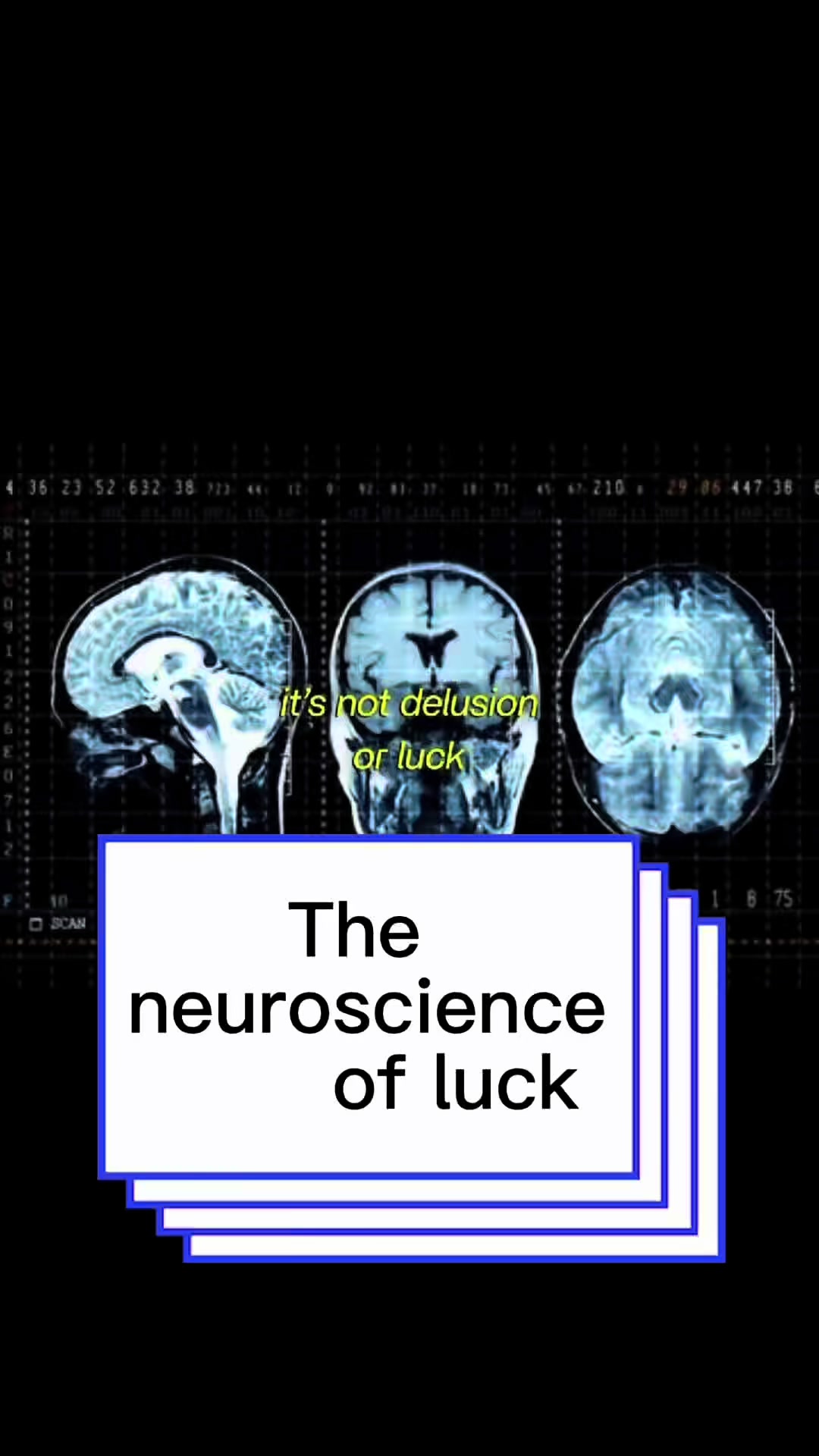 @Braindoc