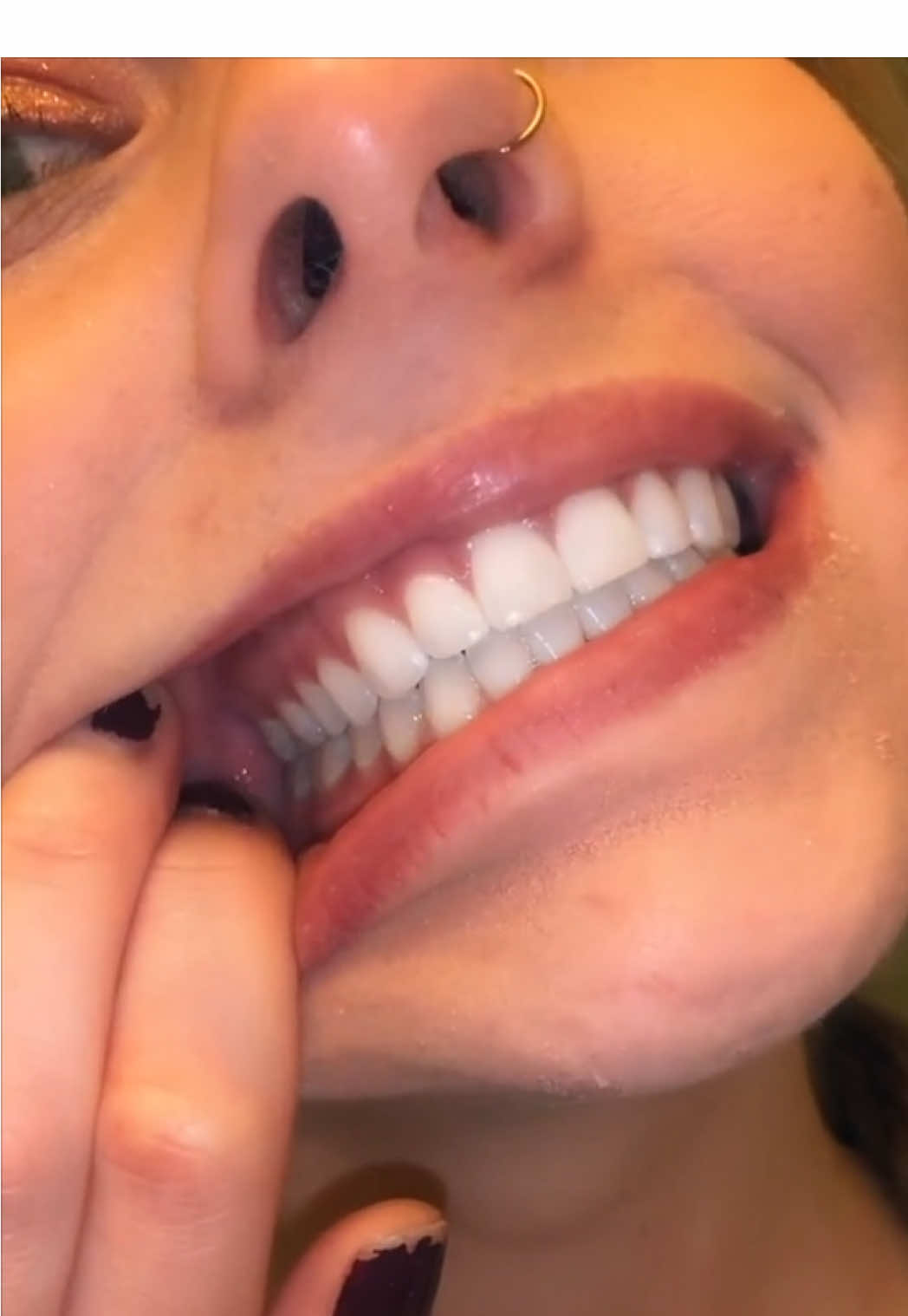 @The Braces Guy