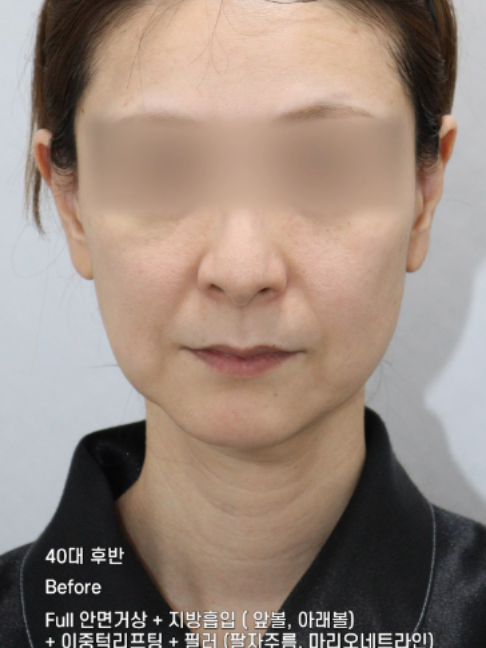 @다시피움성형외과 DASIPIUM タシピウム