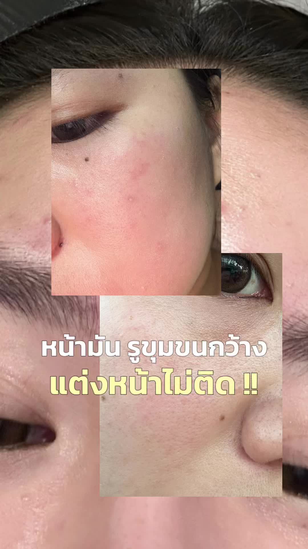 @Pimmyymyypim