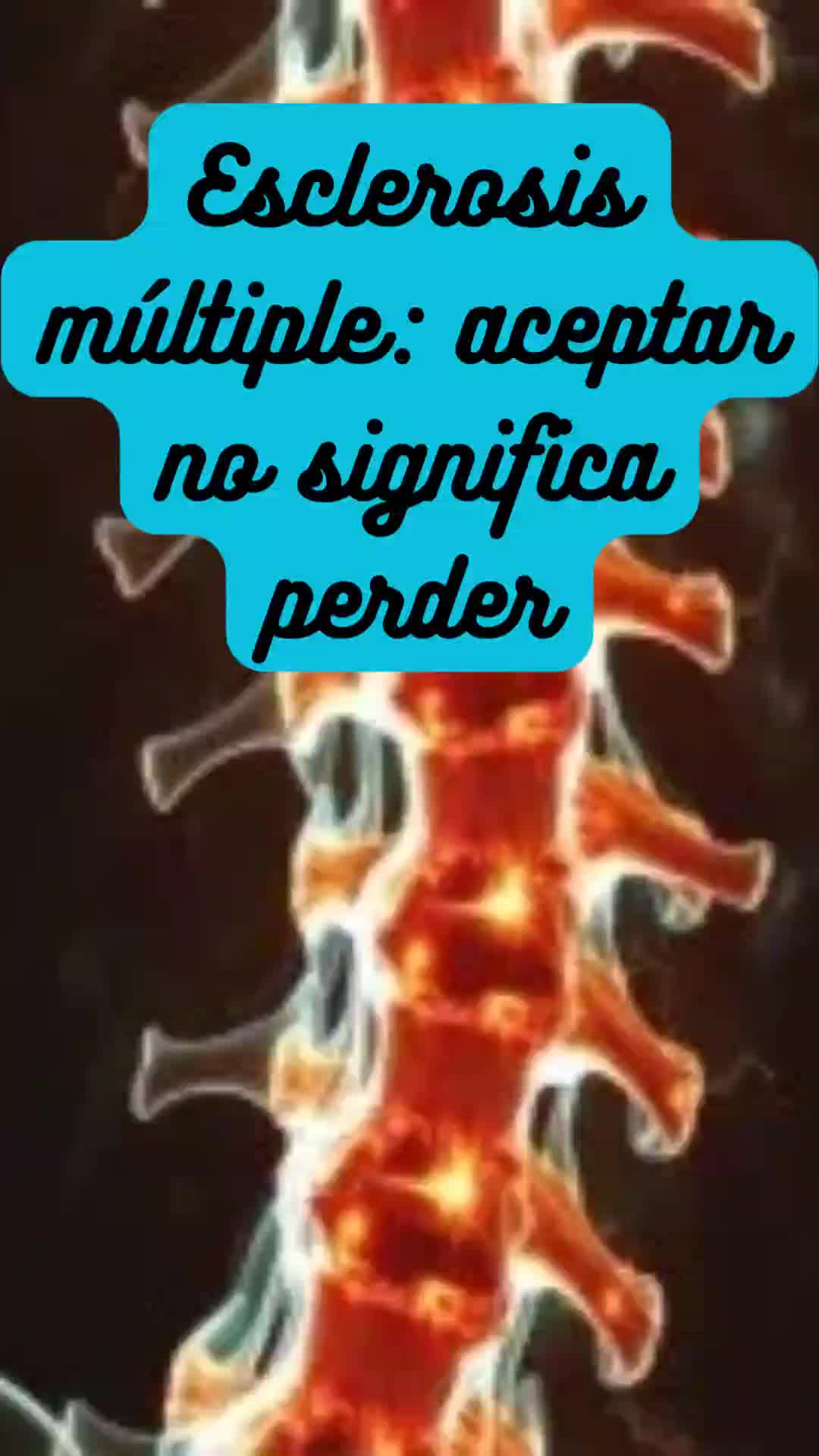 @Entendiendo la EM