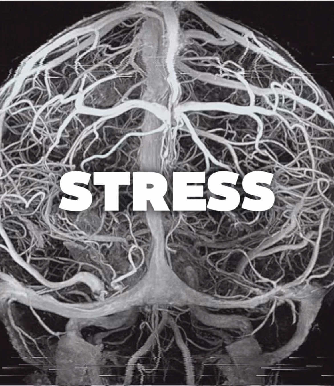 @BrainShift