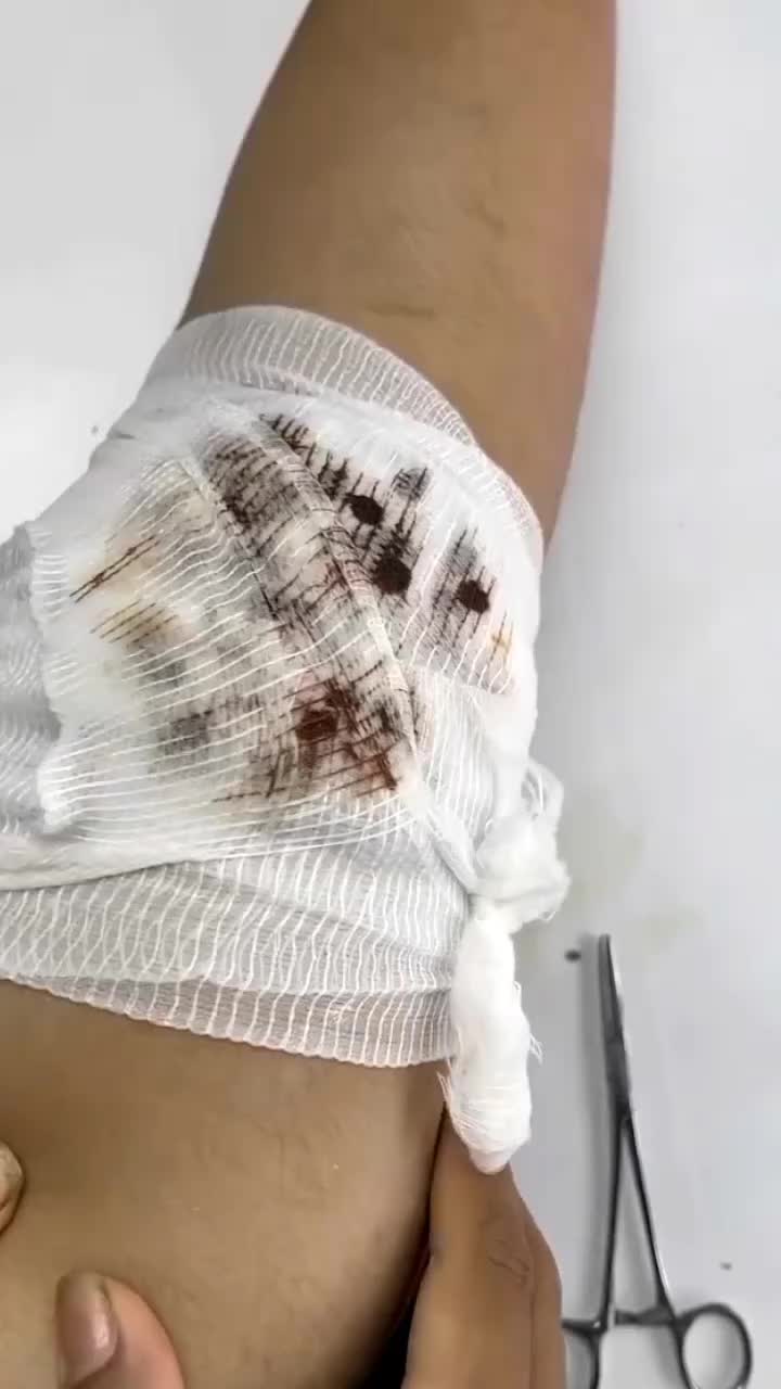 @tickyouu