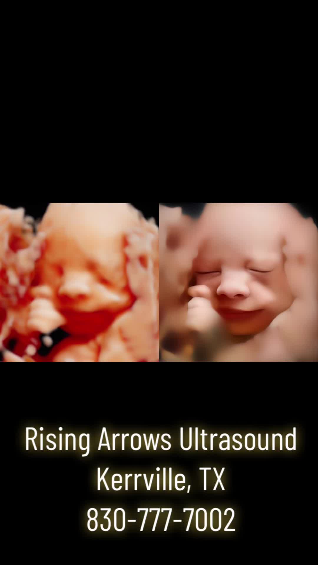 @RISING ARROWS 3D 4D HD 8K