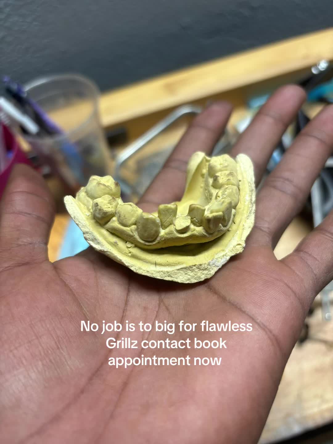 @Flawless Grillz