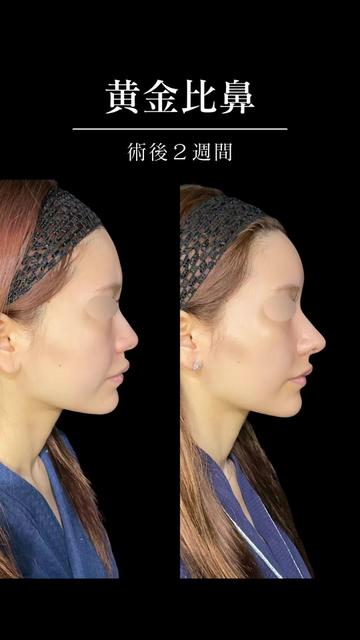 @ソ院長(バウム美容外科/トータル整形)