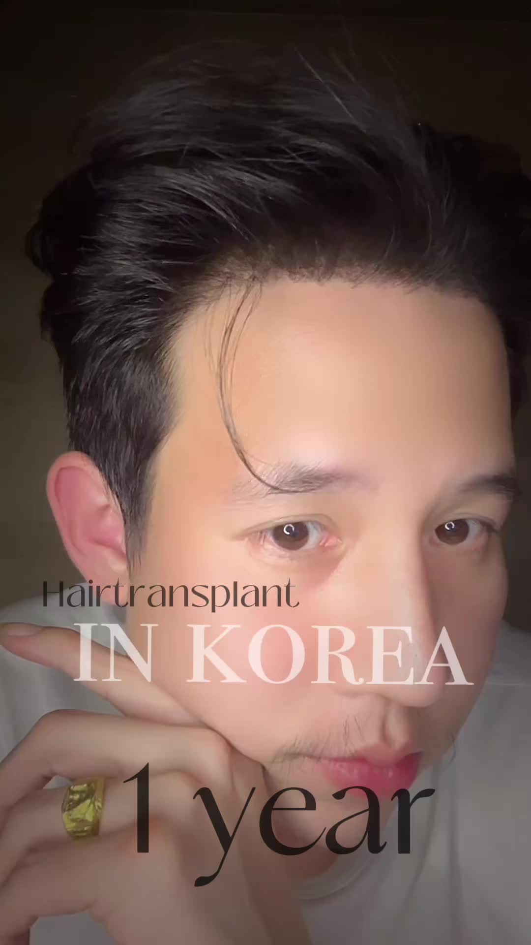 @Sanchai Akkarachaimo