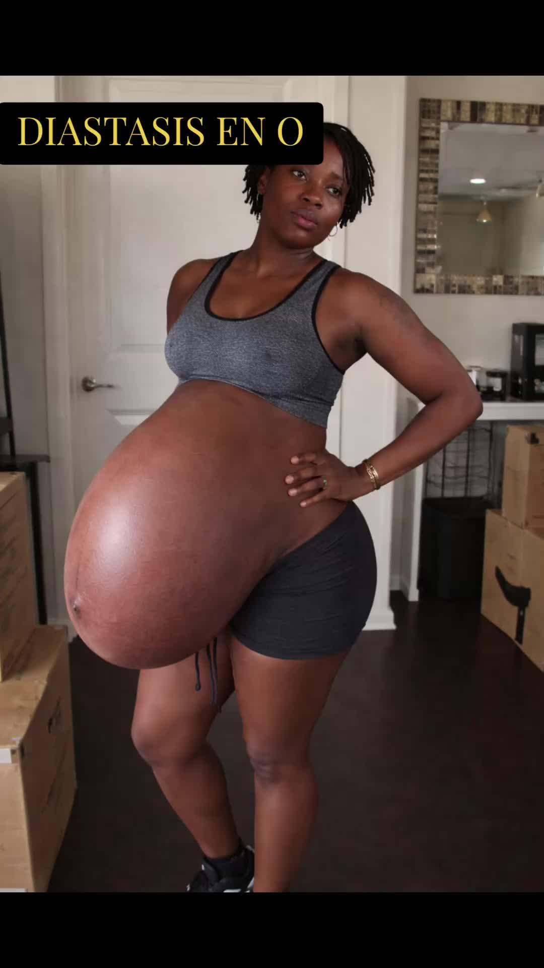 @DIASTASIS /Périnée