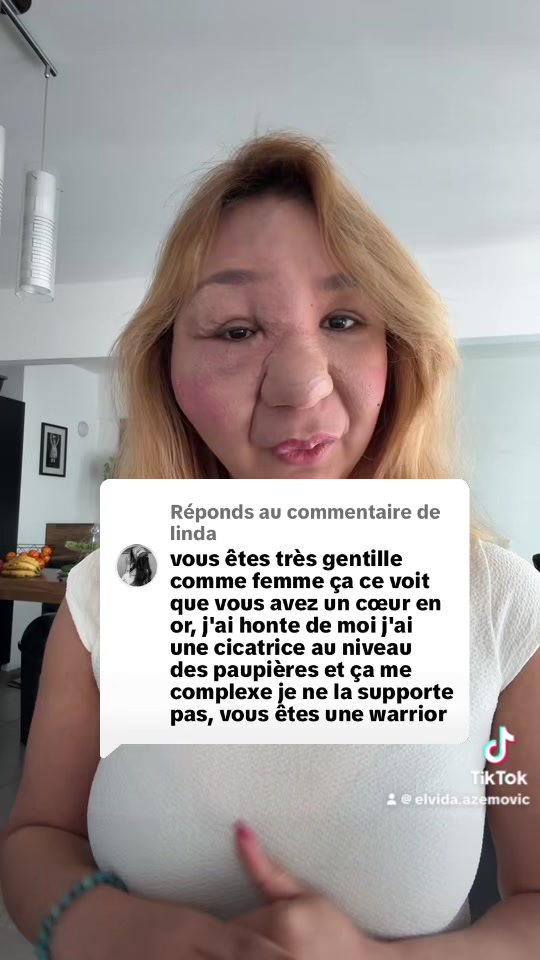 @Elvida Azemovic