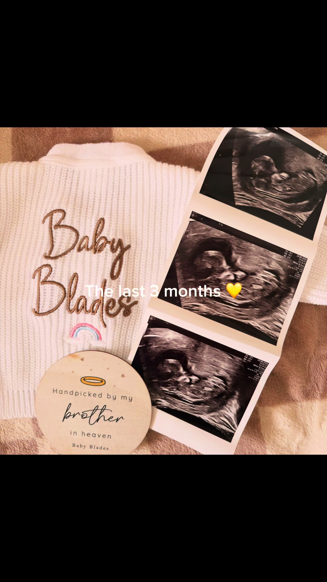 @H | pregnancy after loss 💛