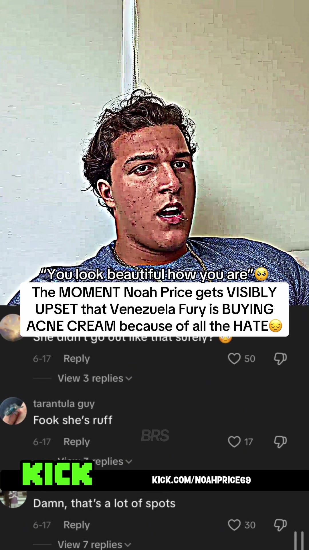 @Brs