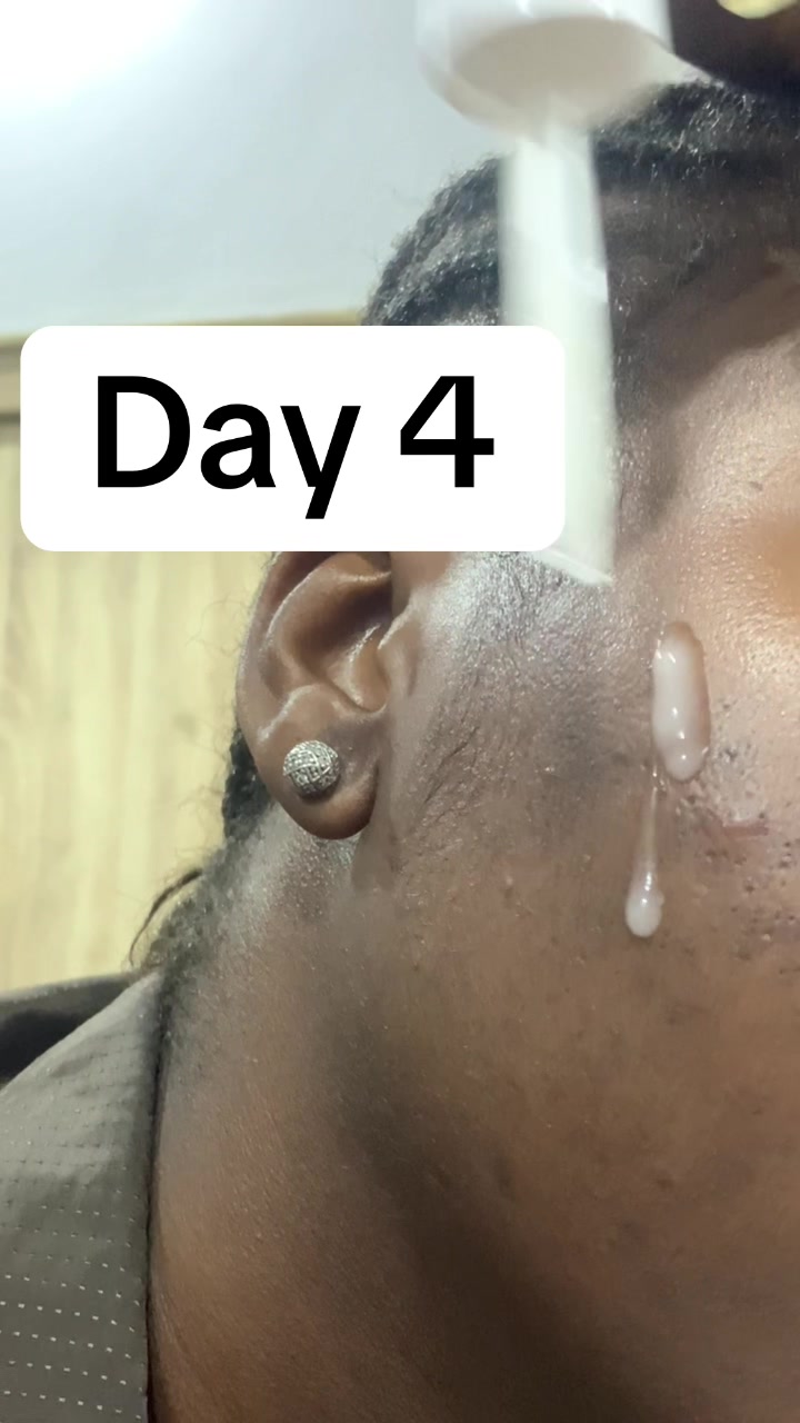 @theskincaregirliee