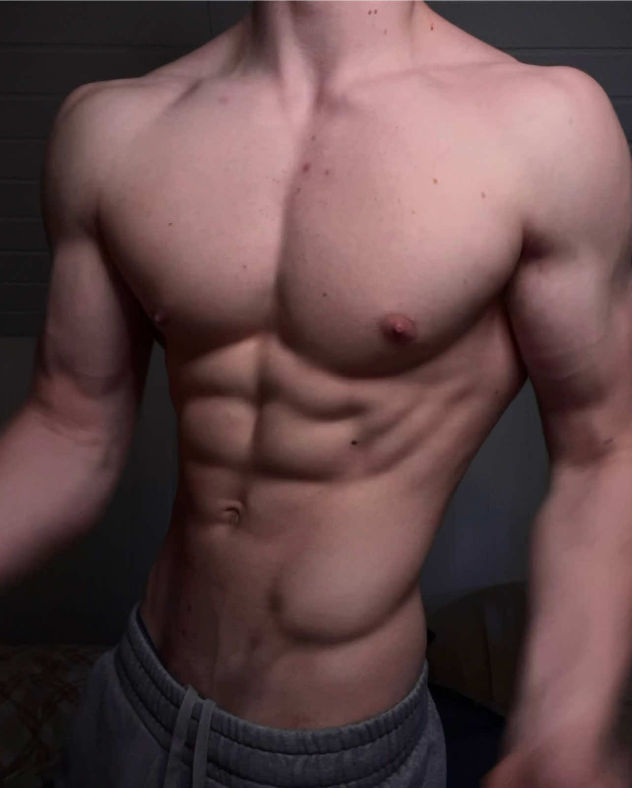 @Albertaesthetic