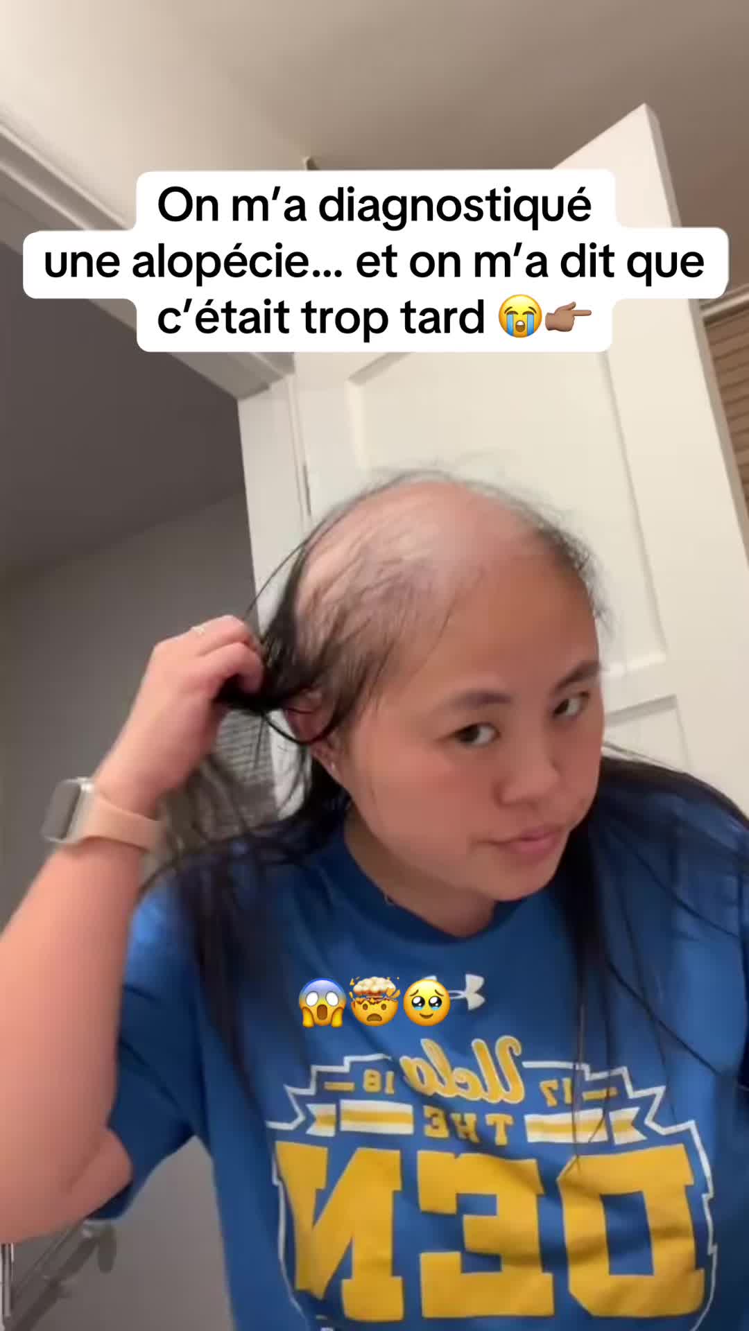 @Lux’Hair Growth FR