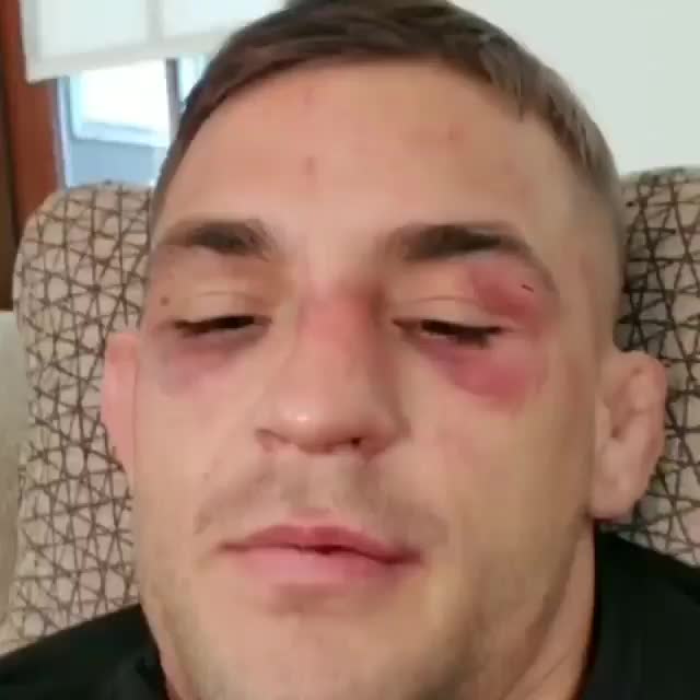 @Dustin "Diamond" Poirier 💎