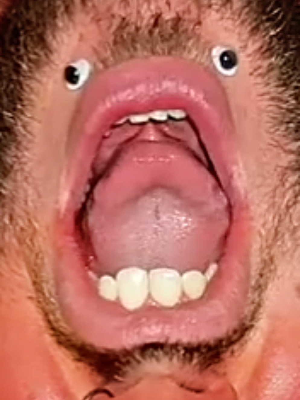 @Chinfaced