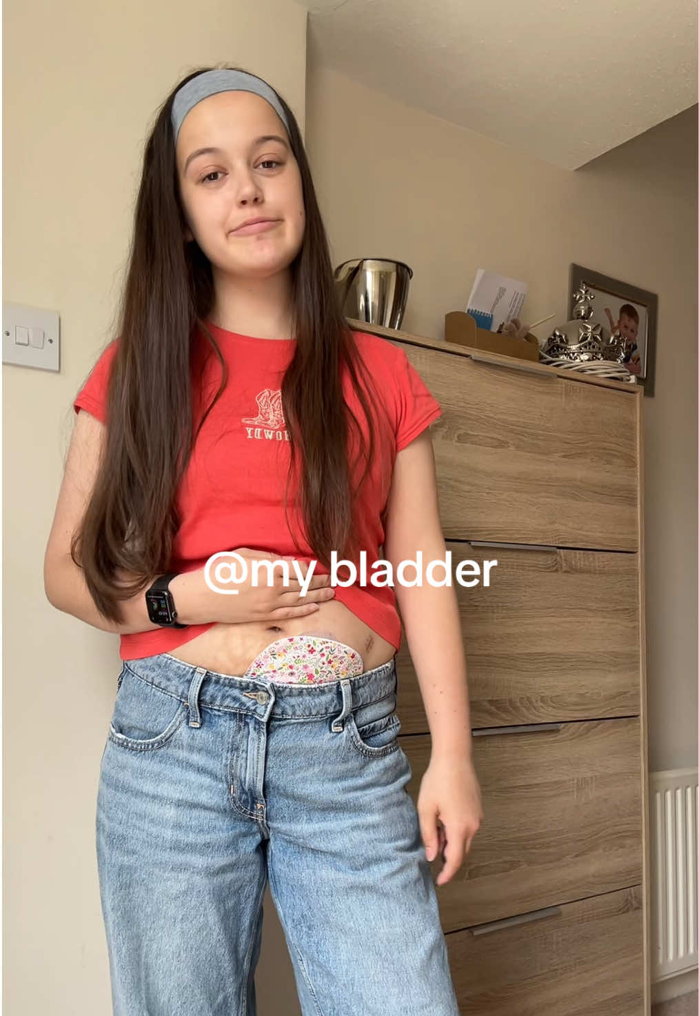 @tonisbrokenbladder