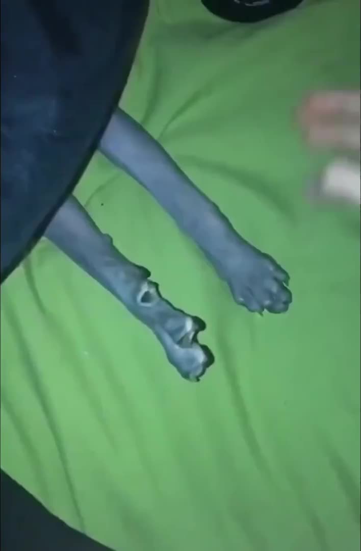 @Derpyoso