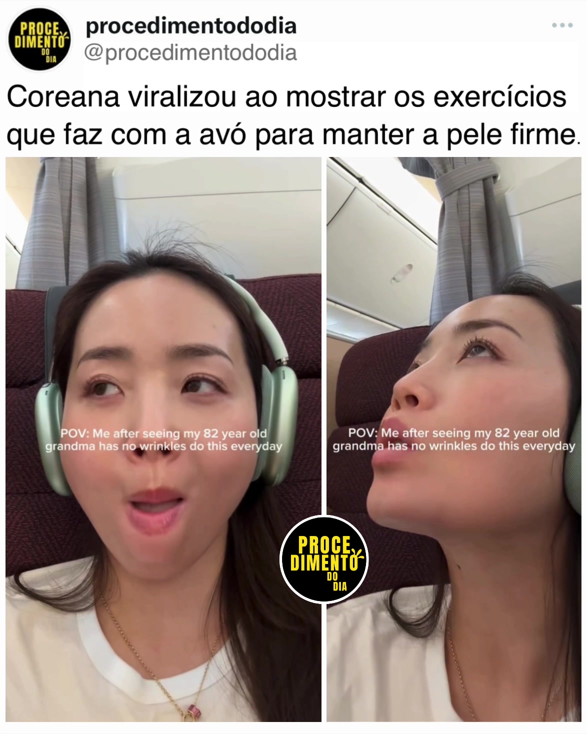 @procedimentododia