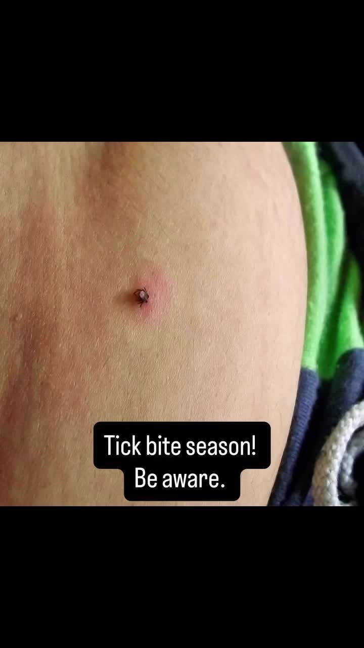@docbroon