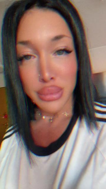 @ely.🍓