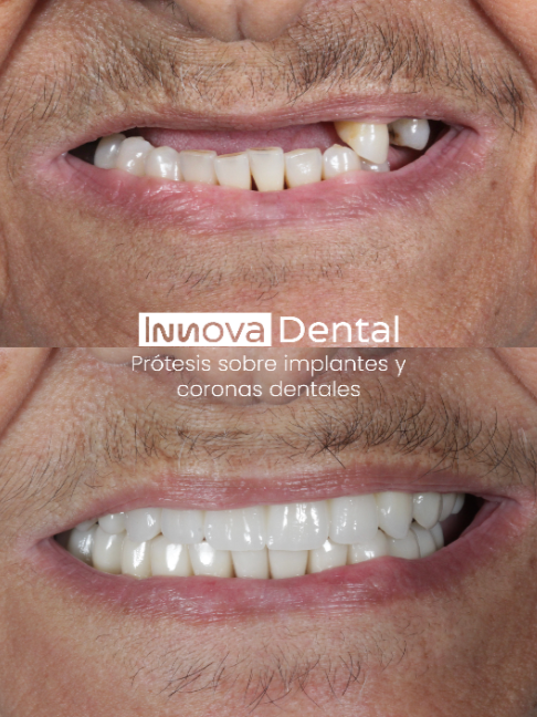 @Innova Dental Managua 🇳🇮