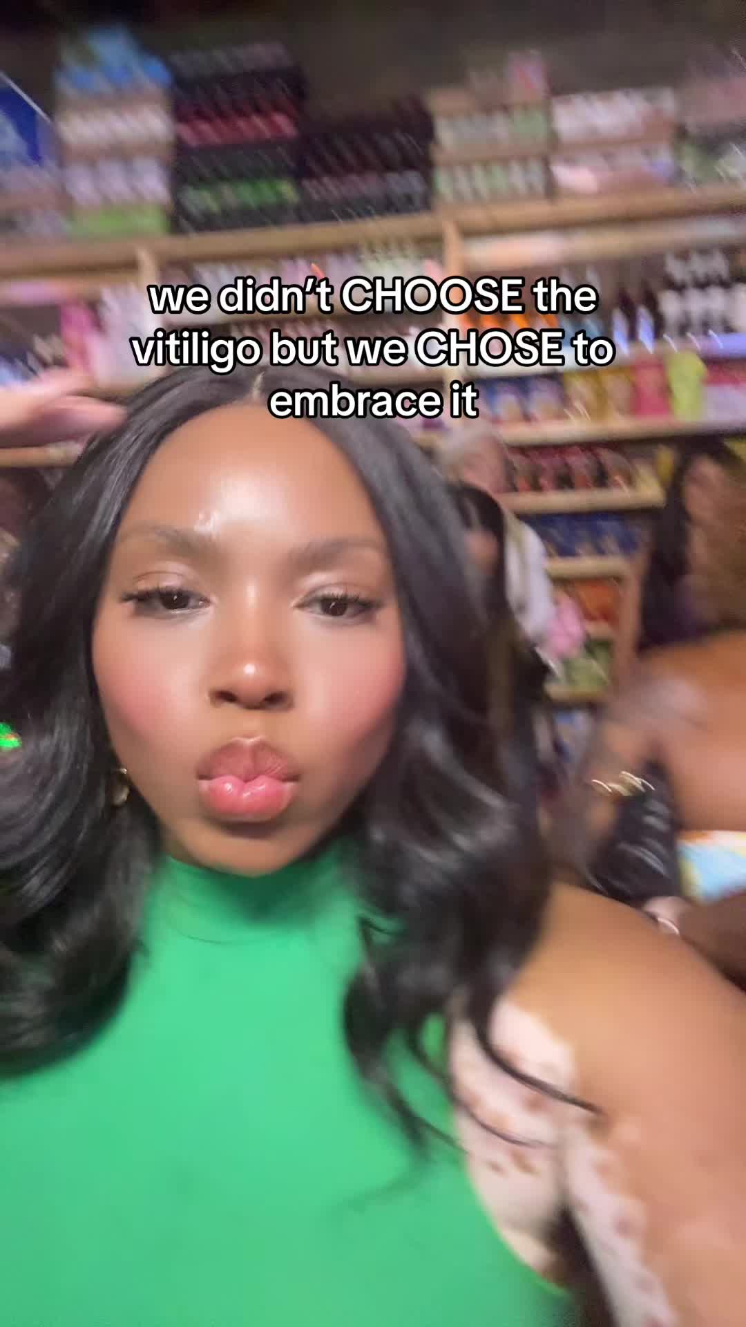 @VitiligoFairy